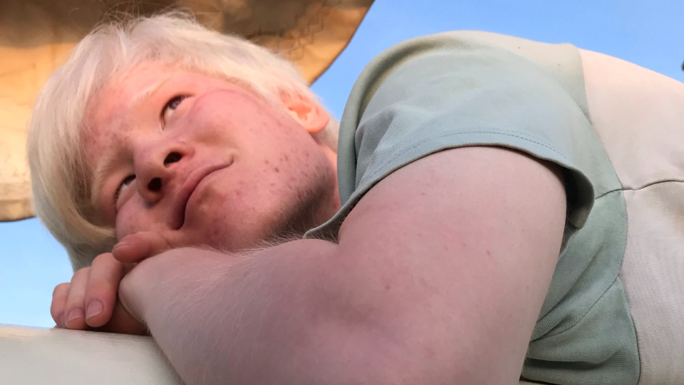 Een foto van Jing. Hij ligt met zijn hoofd op zijn armen en kijkt weg van de camera. Een foto van Jing. Hij ligt met zijn hoofd op zijn armen en kijkt weg van de camera.